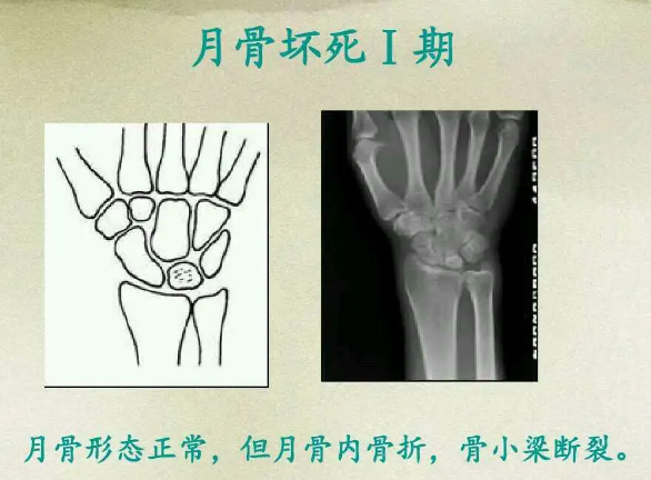 邵陽創(chuàng)傷骨科,邵陽風(fēng)濕病區(qū),邵陽骨質(zhì)增生,邵陽關(guān)節(jié)病區(qū),邵陽頸椎病區(qū)